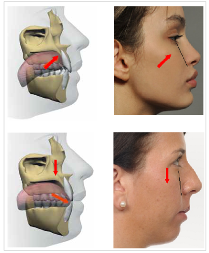 ROCKJAW Jawline Gum - What is Mewing – ROCKJAW®