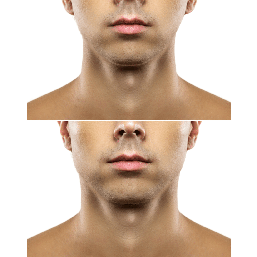 Top five facial exercises for a sharp jawline 