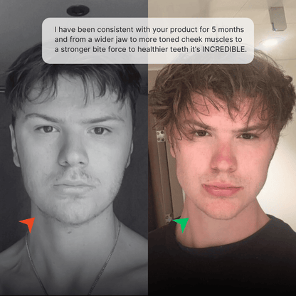 Chicle ROCKJAW® Hard Jawline - Tuff Gum 2.0 con vitaminas B (sin estimulantes)